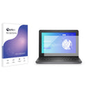 Optic+ Blue Light Blocking Screen Protector for Dell Latitude 3140 2-in-1