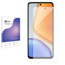 Blue Light Blocking Screen Protector for Vivo T4x.